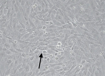 C: Morphological abnormality present, genome error (+)